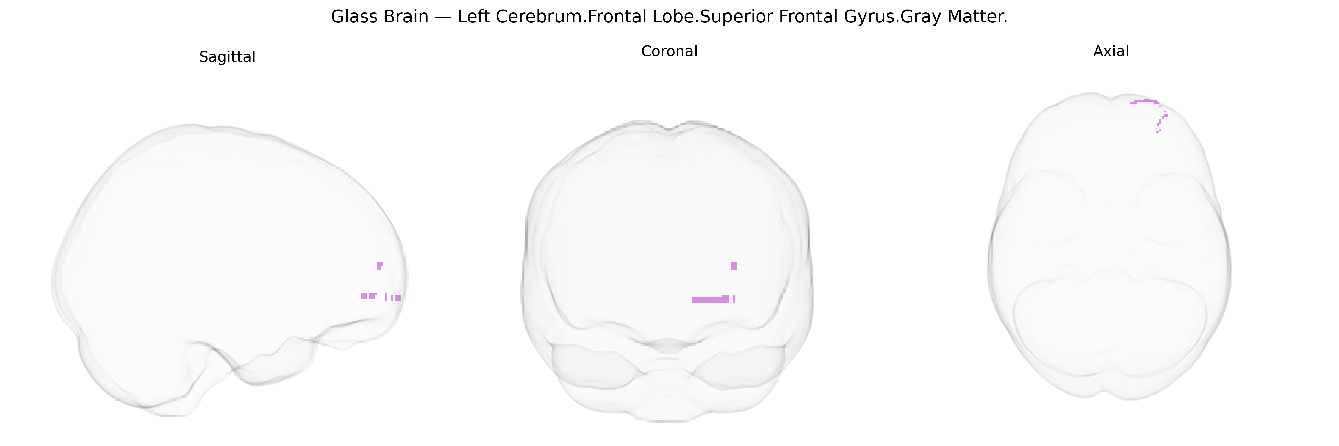 Triplanar Ghost Brain