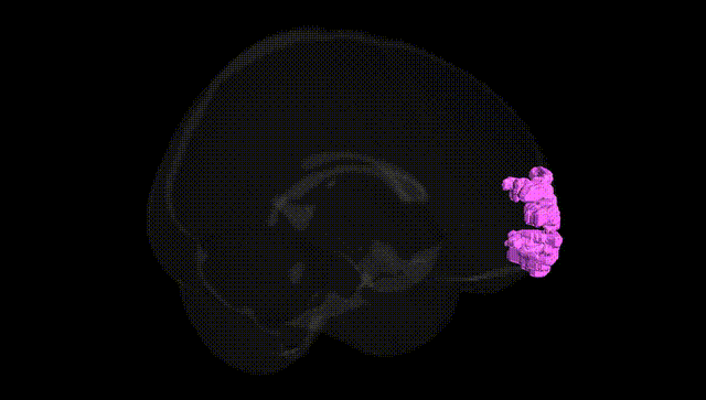 Full Brain Black