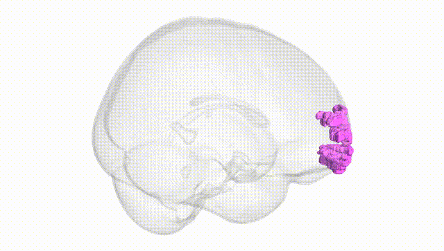 Full Brain White