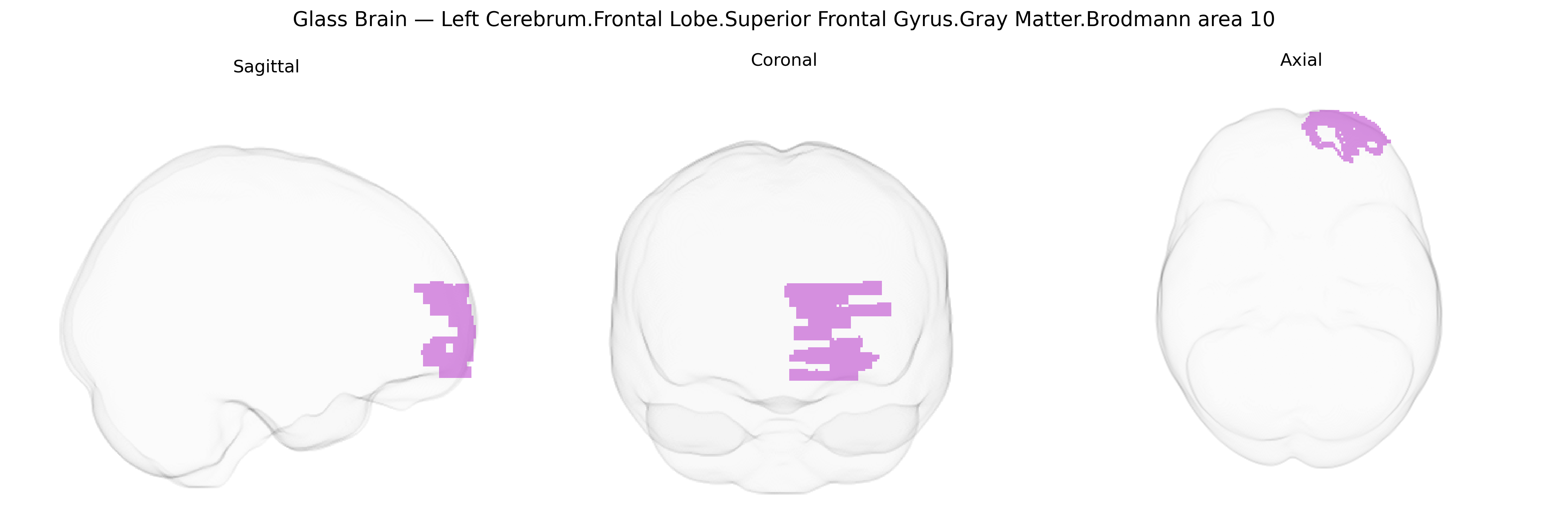 Triplanar Ghost Brain