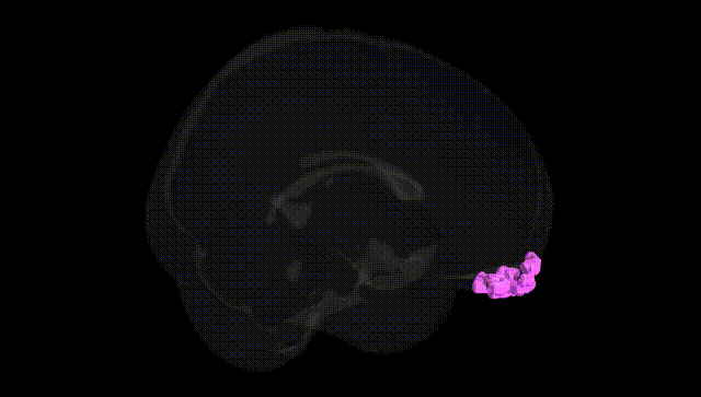 Full Brain Black