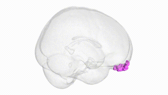 Full Brain White