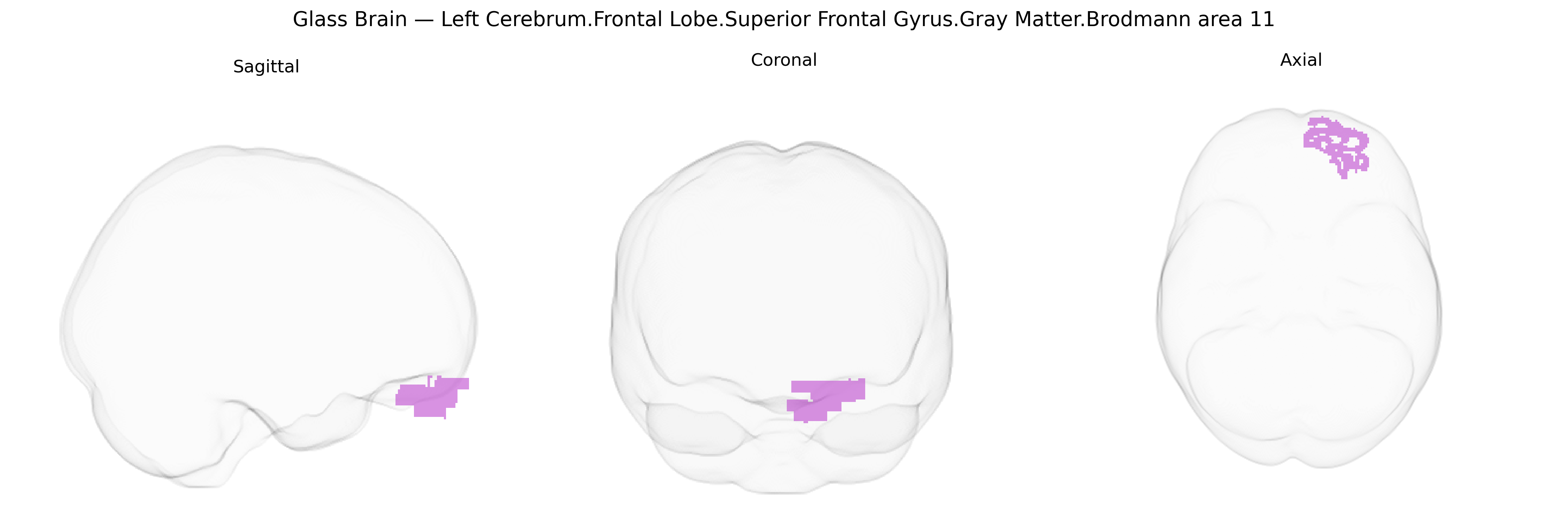 Triplanar Ghost Brain