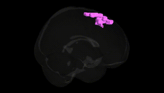 Full Brain Black