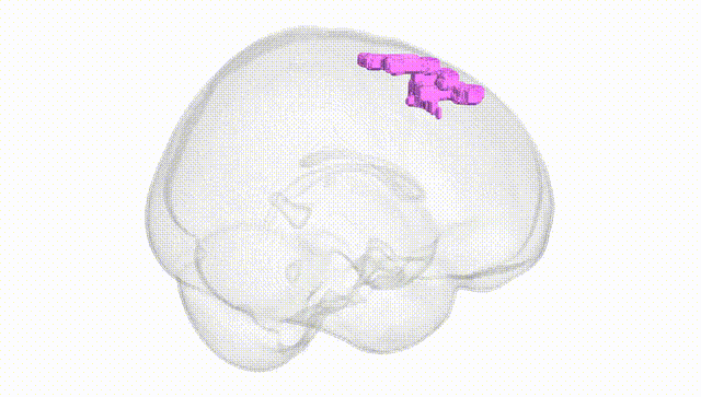 Full Brain White