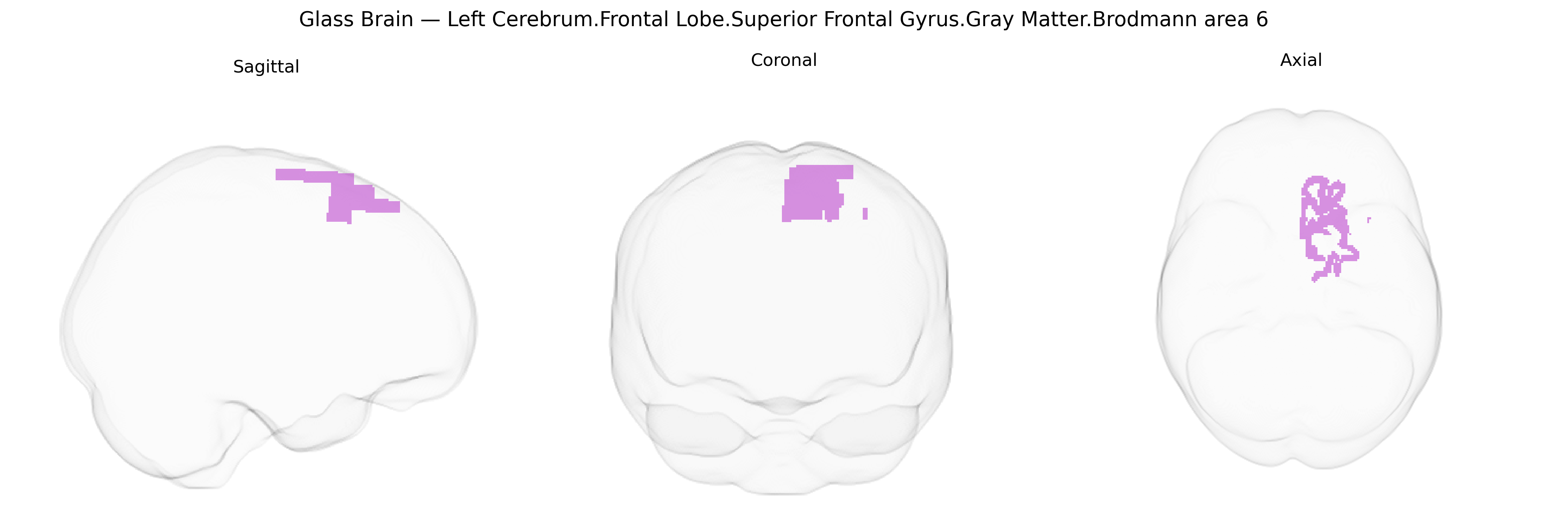 Triplanar Ghost Brain
