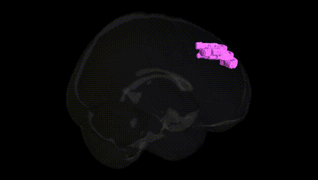Full Brain Black