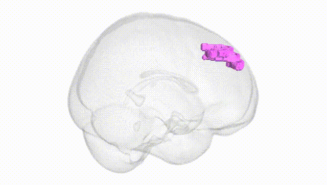 Full Brain White