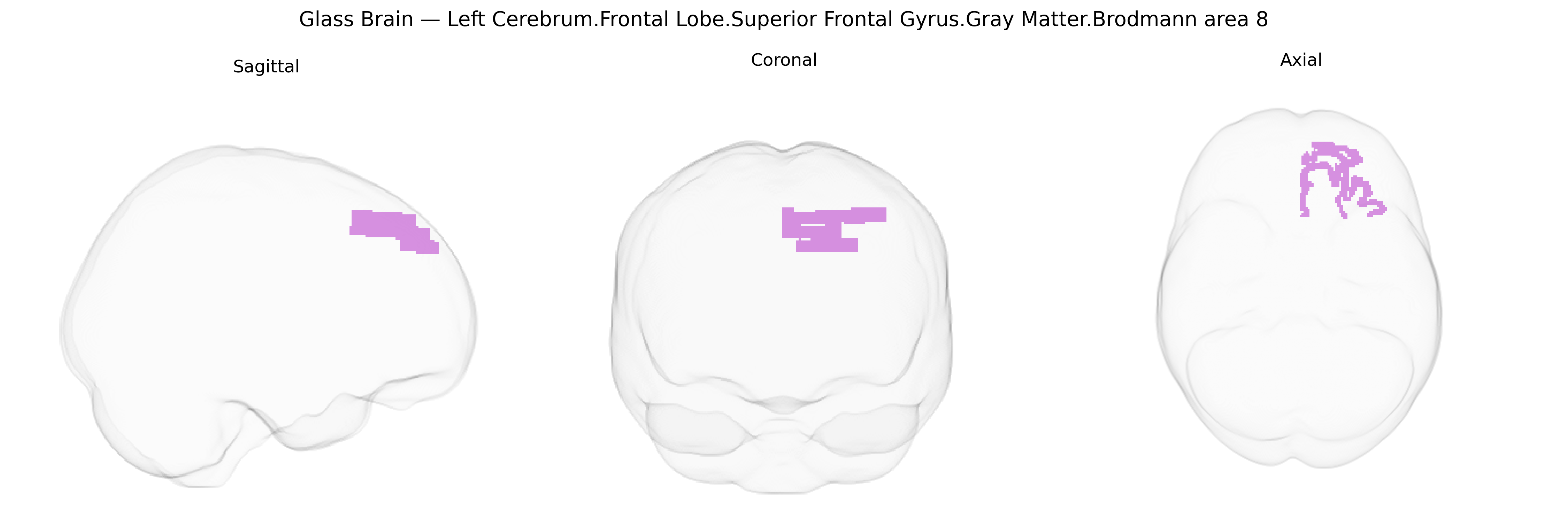 Triplanar Ghost Brain