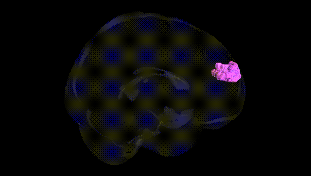 Full Brain Black