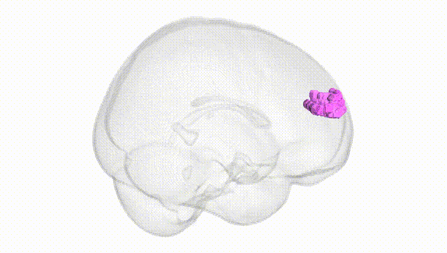 Full Brain White