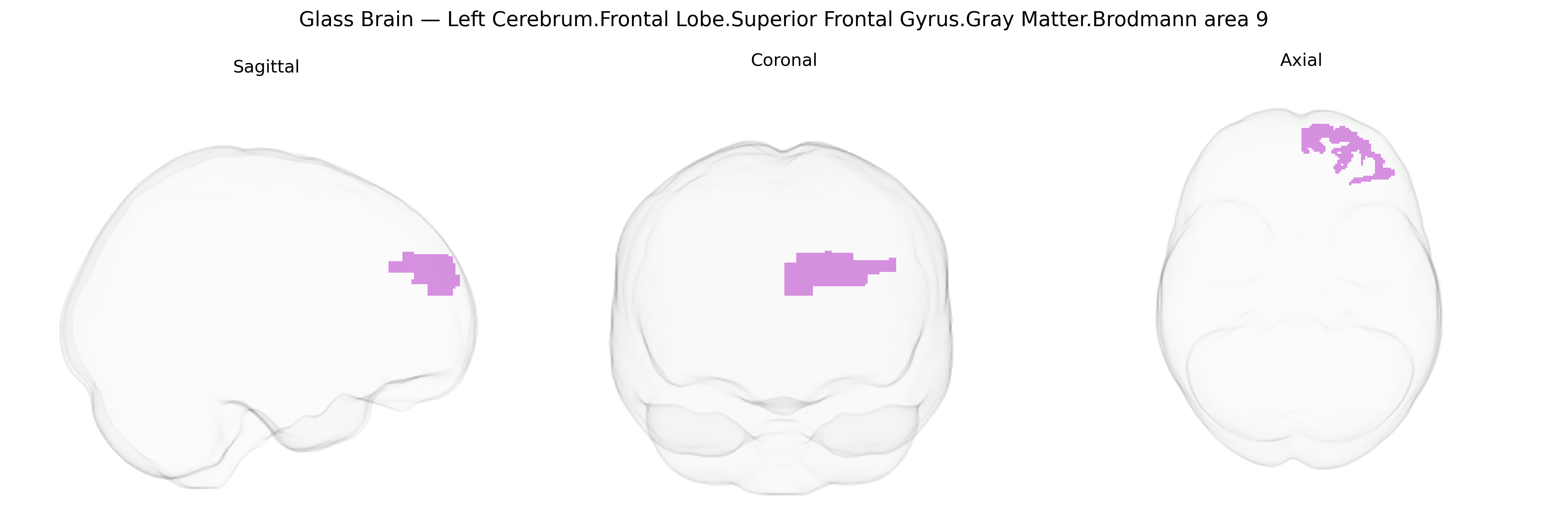 Triplanar Ghost Brain