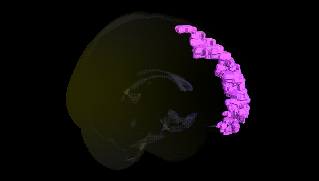 Full Brain Black