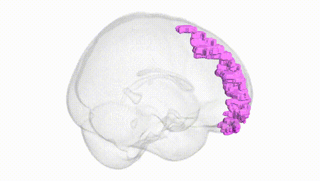 Full Brain White