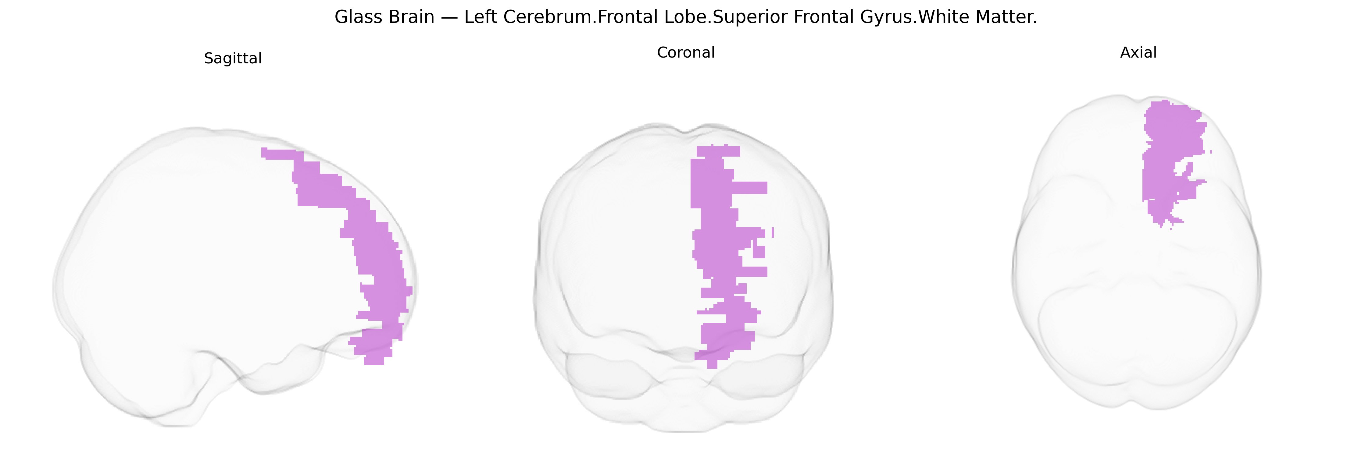 Triplanar Ghost Brain