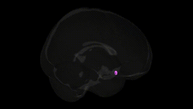 Full Brain Black