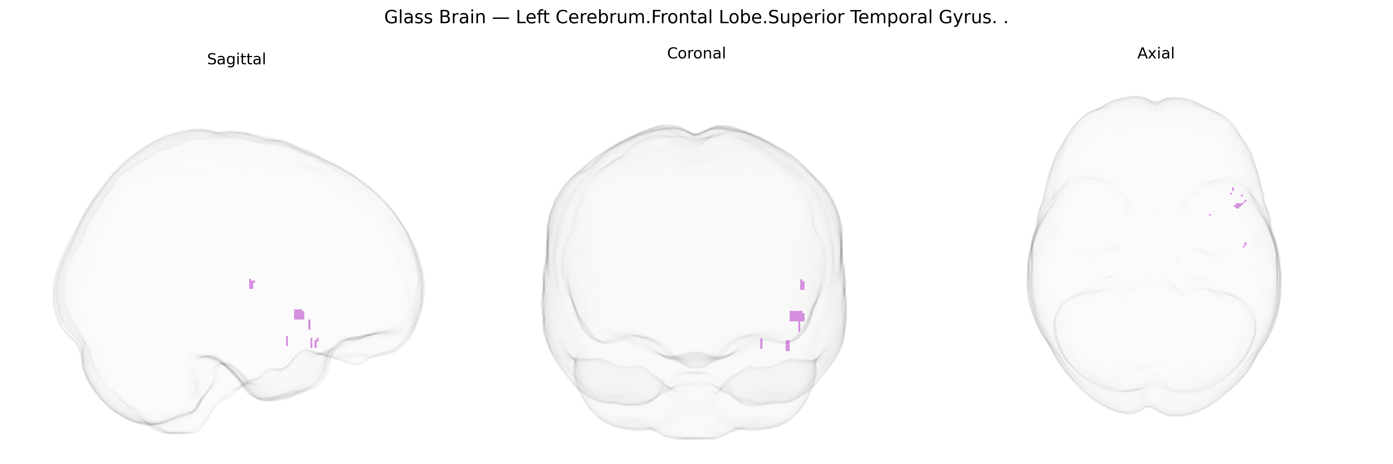Triplanar Ghost Brain
