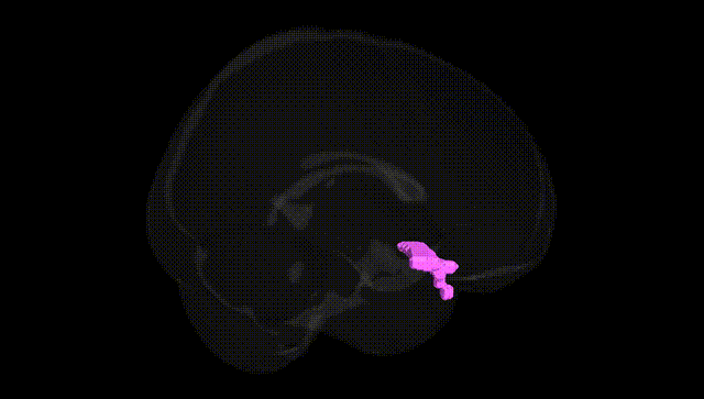 Full Brain Black