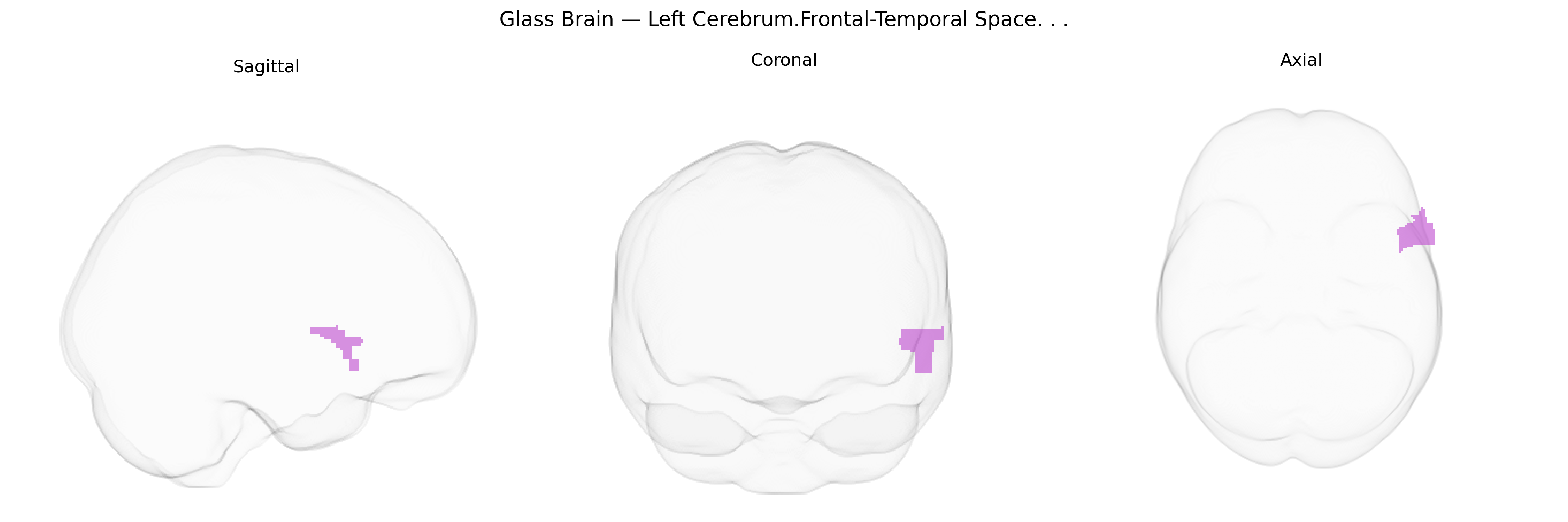 Triplanar Ghost Brain