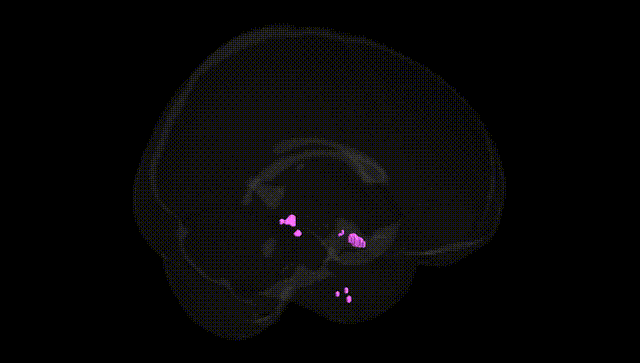 Full Brain Black