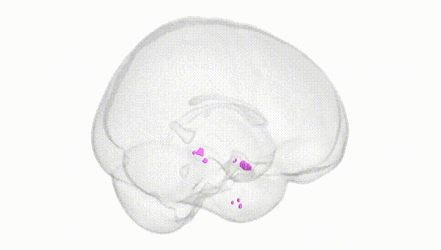 Full Brain White