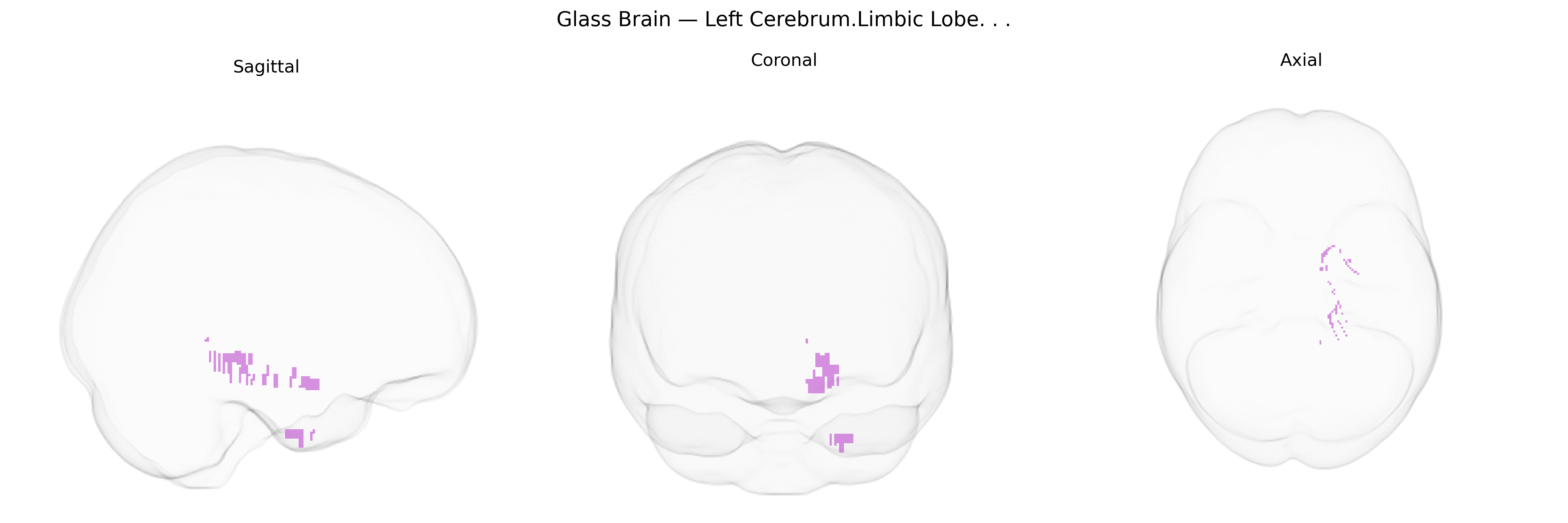 Triplanar Ghost Brain