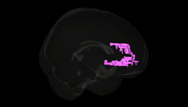 Full Brain Black