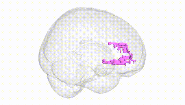 Full Brain White