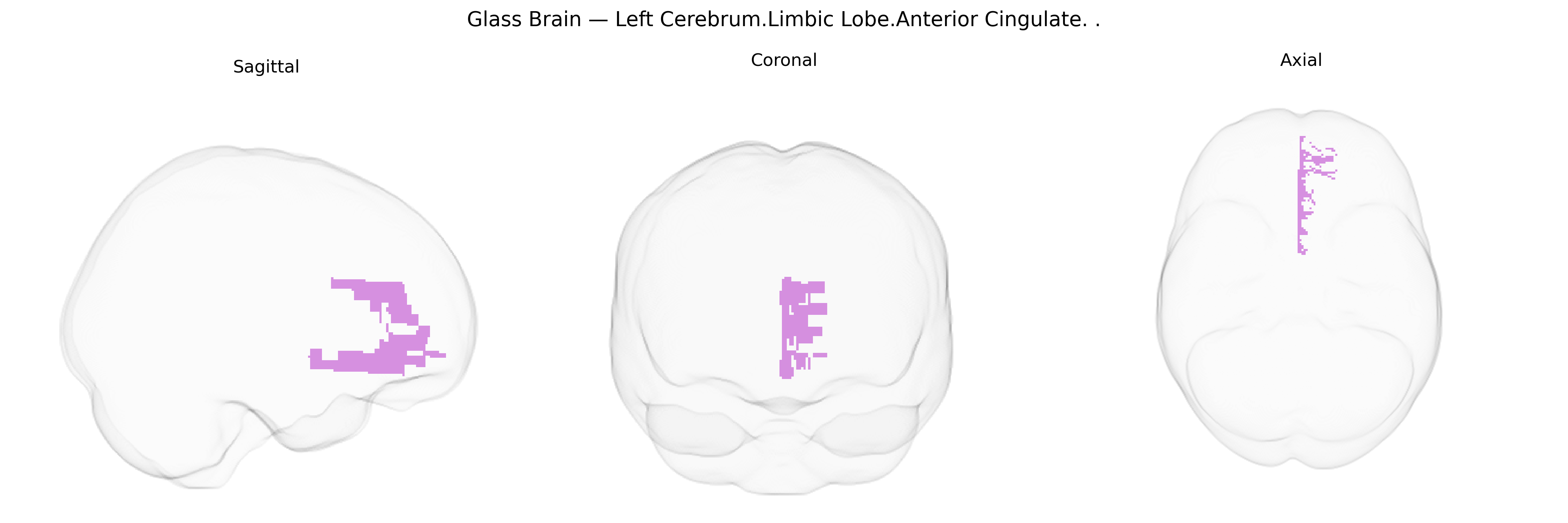 Triplanar Ghost Brain