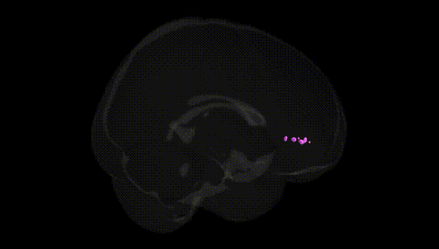 Full Brain Black