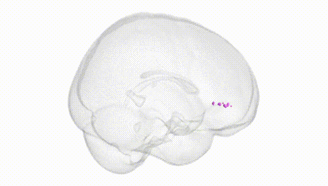 Full Brain White