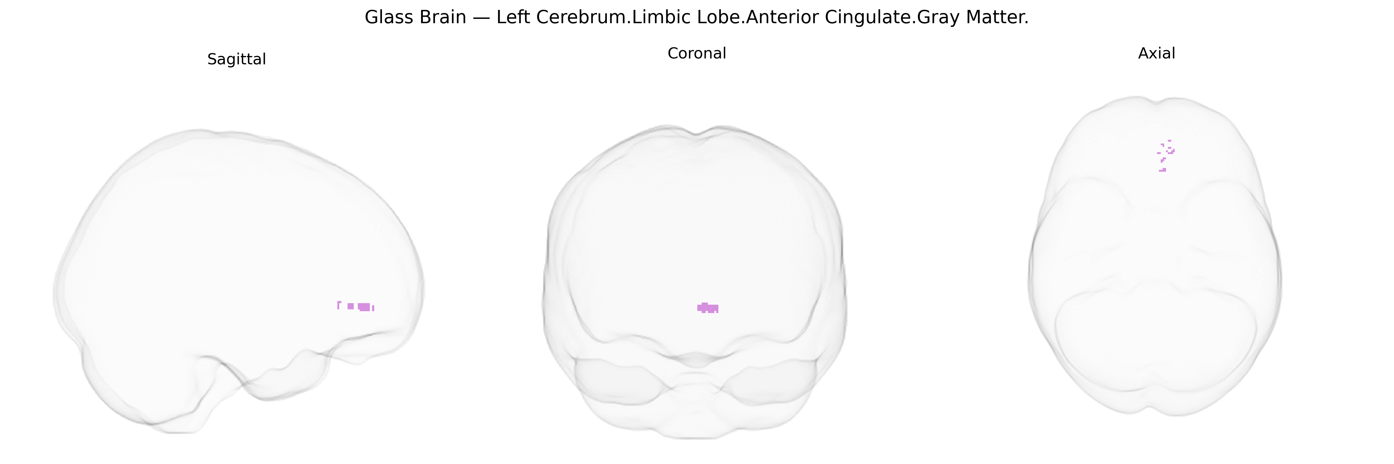 Triplanar Ghost Brain