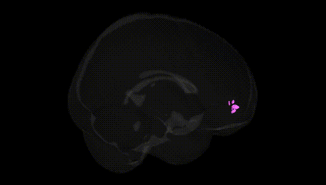 Full Brain Black