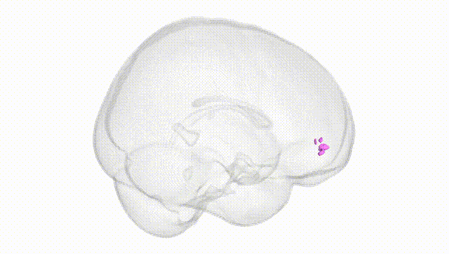 Full Brain White
