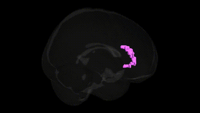 Full Brain Black