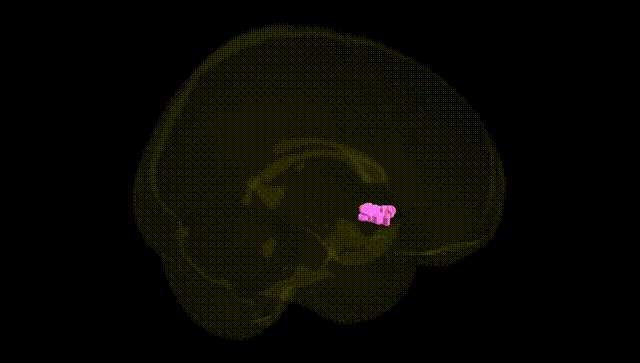 Full Brain Black