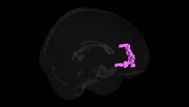 Full Brain Black
