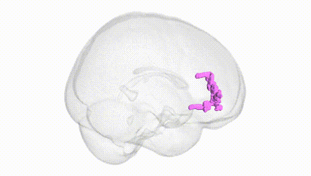 Full Brain White
