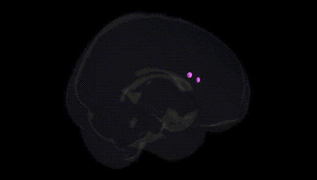 Full Brain Black