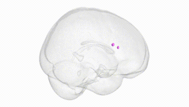 Full Brain White