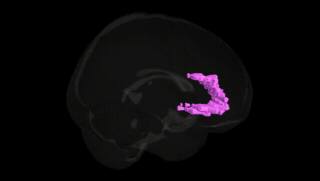 Full Brain Black
