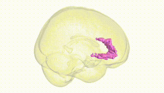 Full Brain White