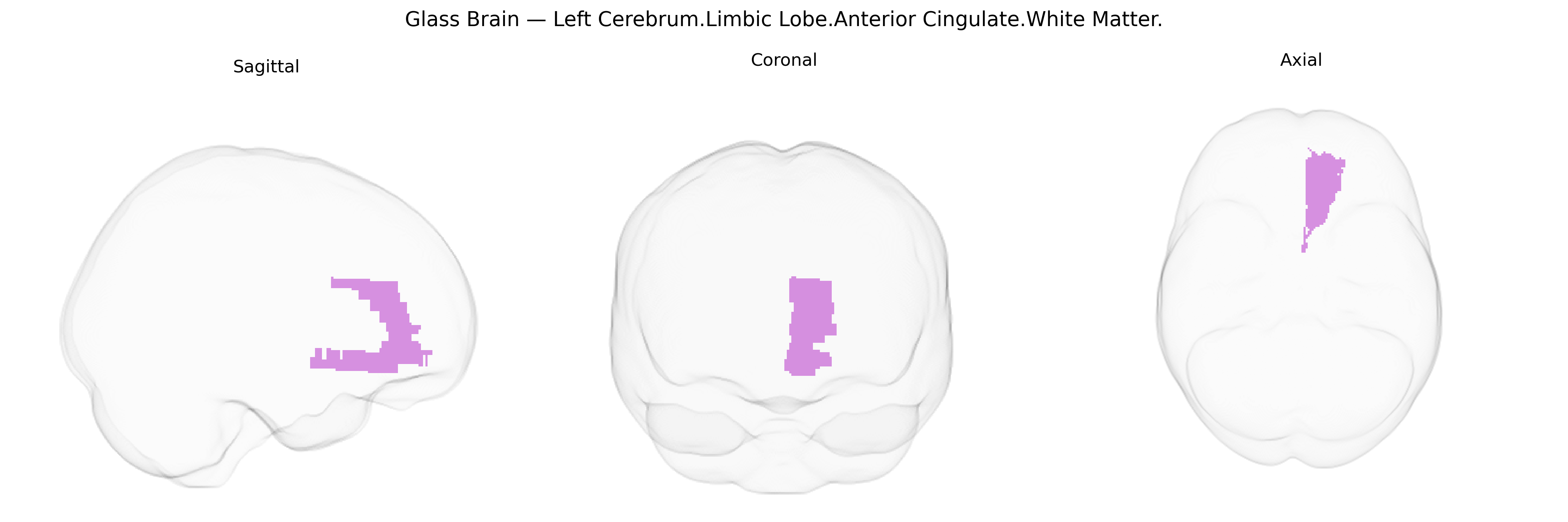 Triplanar Ghost Brain