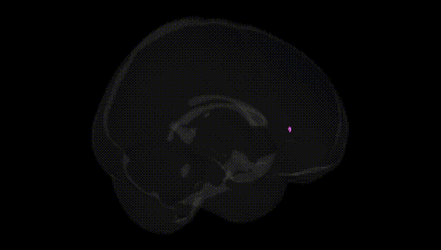 Full Brain Black