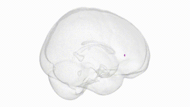 Full Brain White