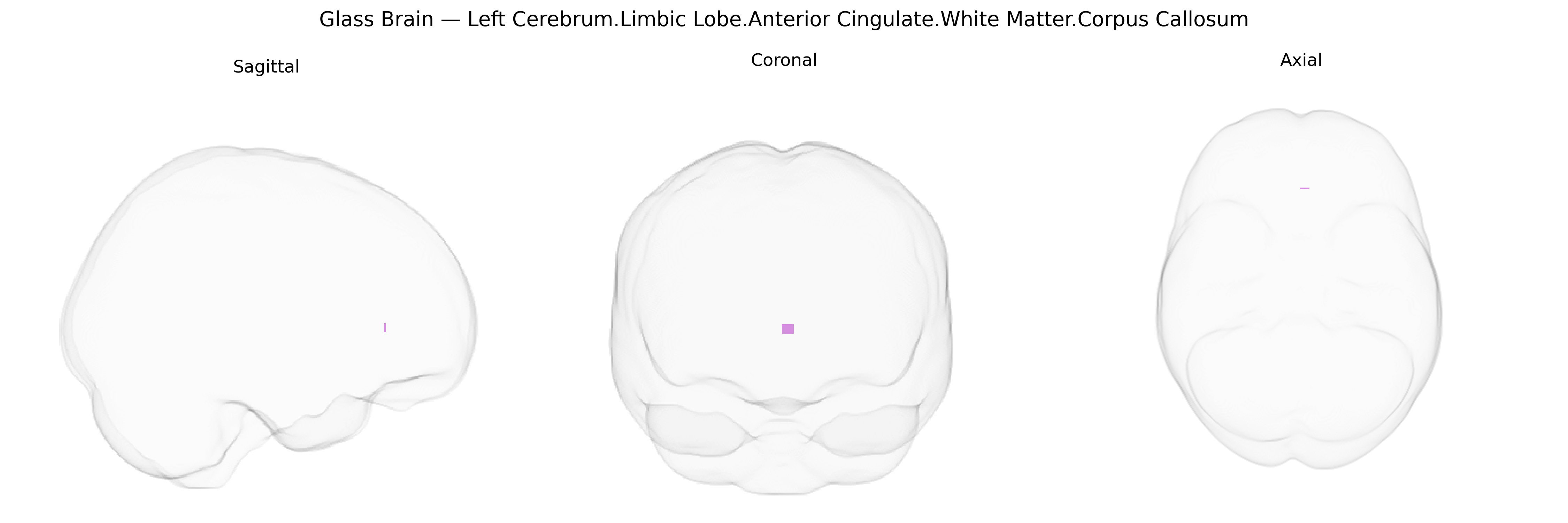 Triplanar Ghost Brain