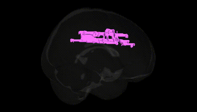Full Brain Black