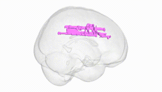 Full Brain White