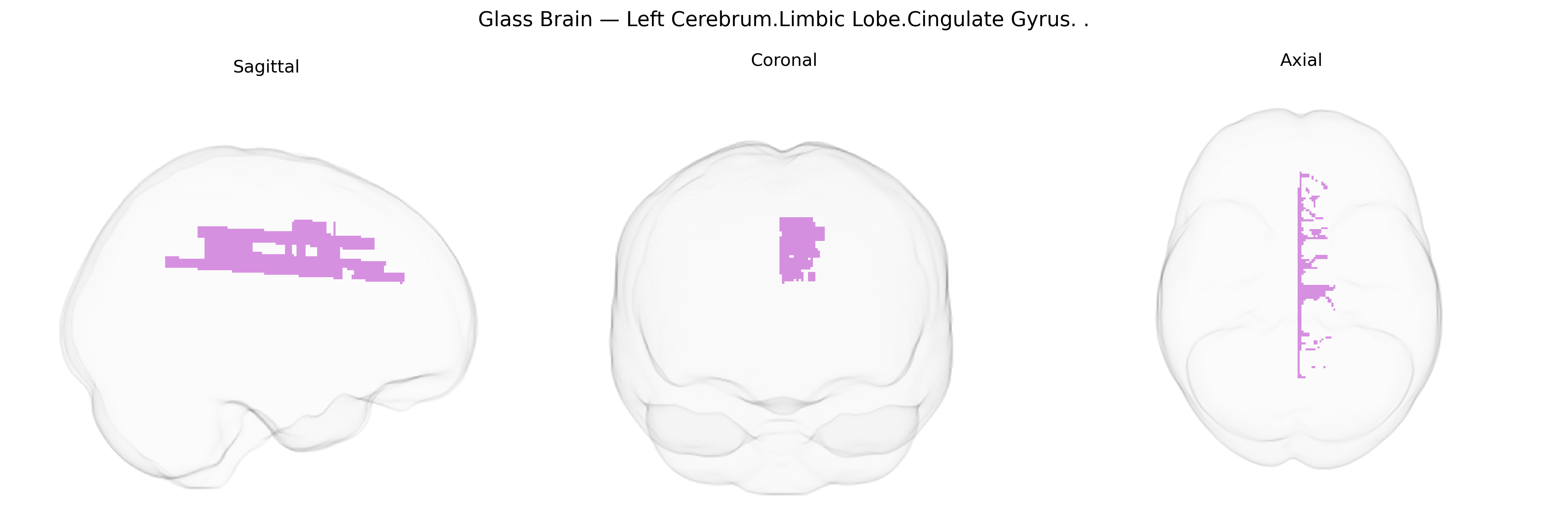 Triplanar Ghost Brain