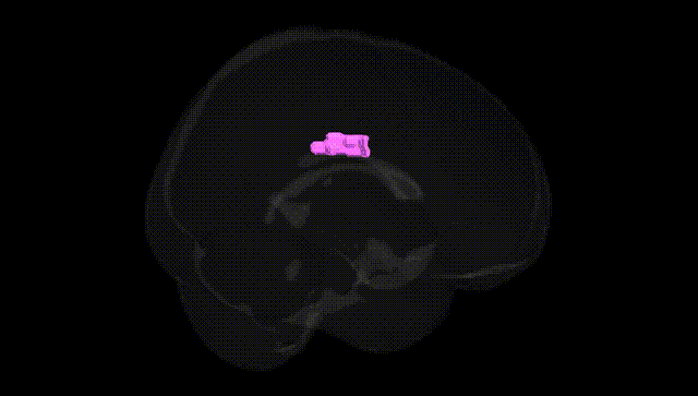 Full Brain Black